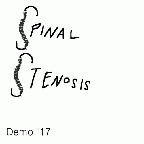 Spinal Stenosis : Demo '17